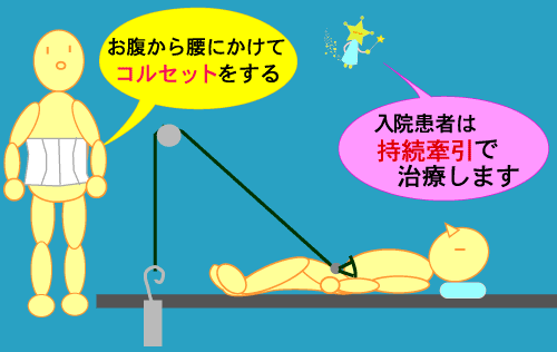 コルセット・持続牽引