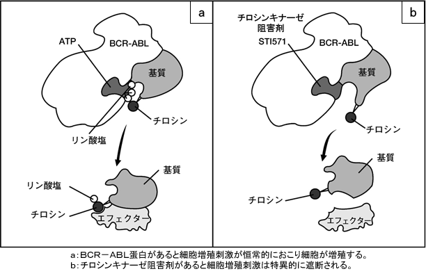 慢性骨髄性白血病│特定非営利活動法人 標準医療情報センター