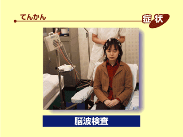 脳波検査