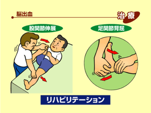 リハビリテーション