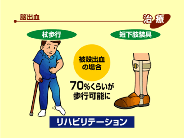 リハビリテーション