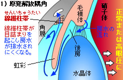 原発解放隅角