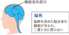 脳死