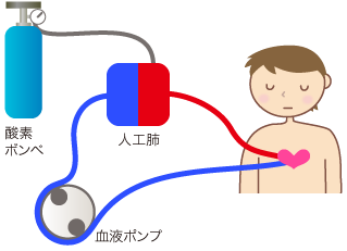 生命維持装置