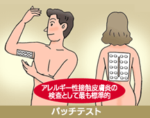 接触皮膚炎│パッチテスト