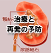 尿路結石症