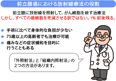 前立腺癌における放射線療法の役割