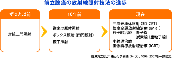 前立腺癌の放射線照射技法の進歩