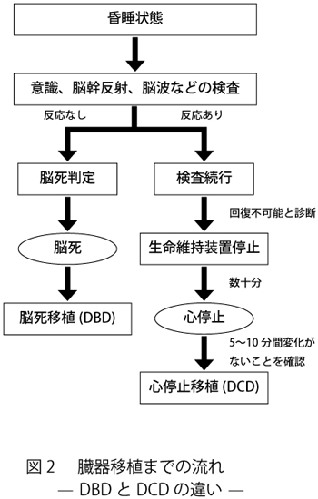 臓器移植までの流れ(DBDとDCDの違い)